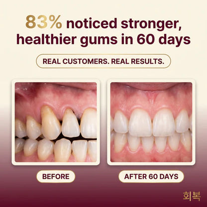 Korean Cavity Healing Tooth Armor