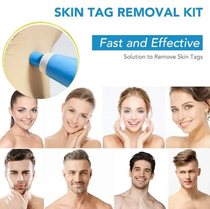 Zavinox 2-in-1 Painless Skin Tag, Mole, and Wart Removal Kit