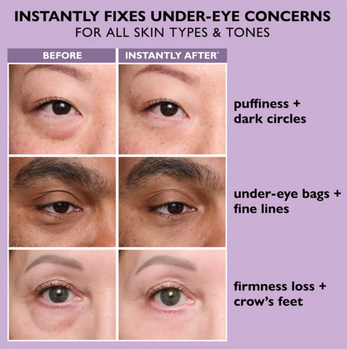 Zavinox Instant Eye-tightener