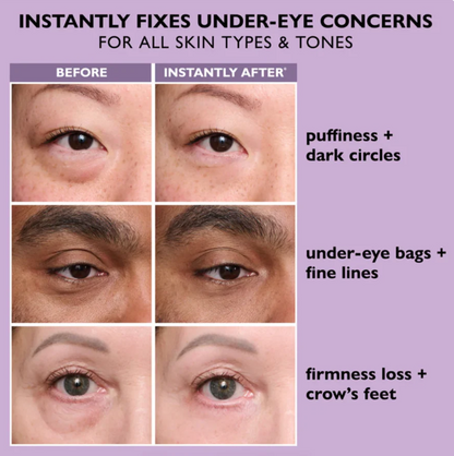 Zavinox Instant Eye-tightener