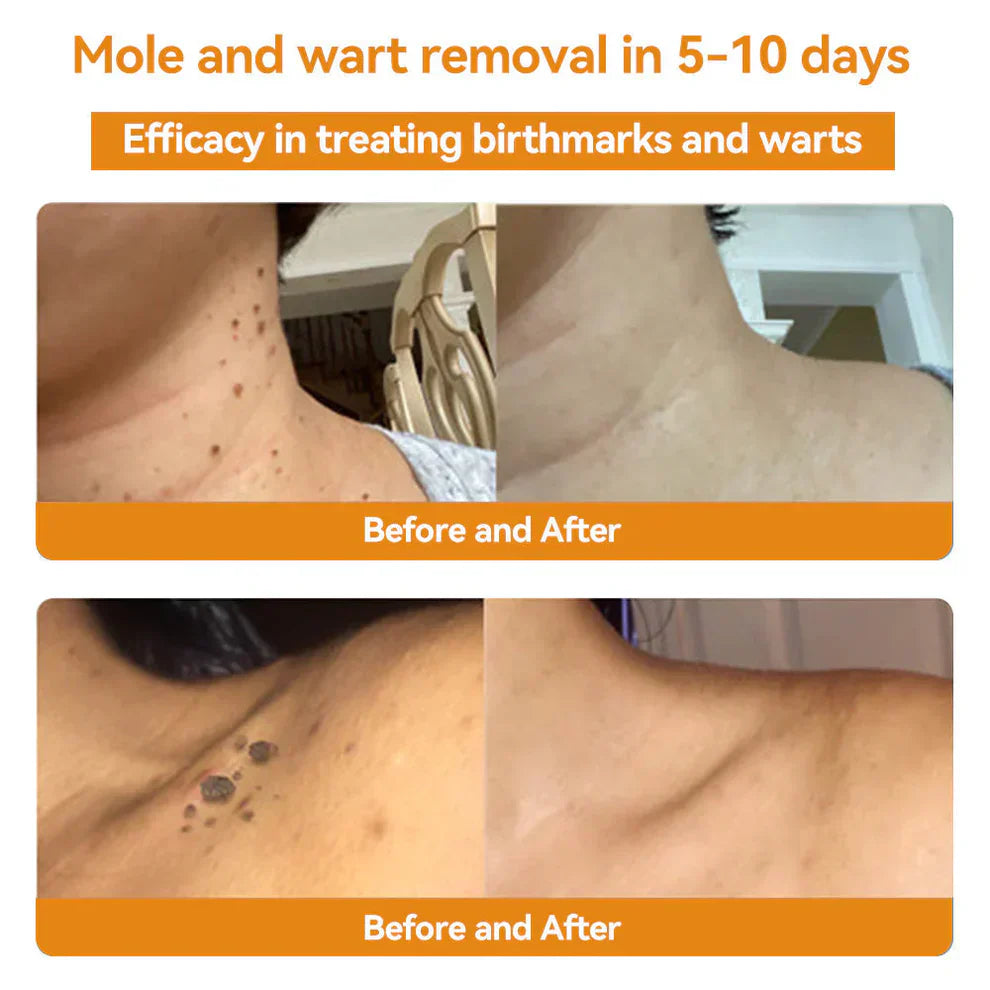 Zavinox Bee Venom Skin Treatment Cream